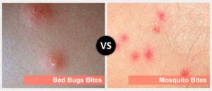 Mosquito and Bedbugs Bites | Public Health