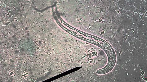 larva de Strongyloides stercoralis - YouTube