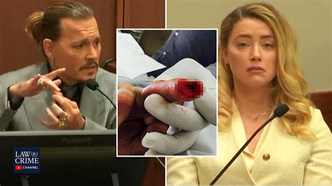 Amber Heard Allegedly Threw Glass Bottle at Johnny Depp That Severed ...