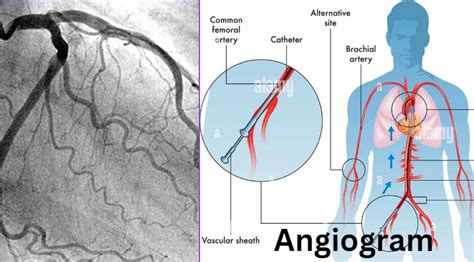 Angiogram Cost in Bangladesh - Professor AKM Manzurul Alam