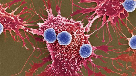 New Weapons Against Cancer: Millions of Bacteria Programmed to Kill ...