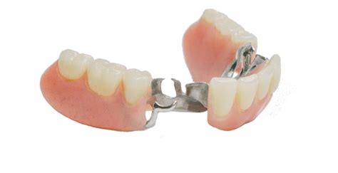 Partial Dentures | Brookswood Denture Clinic