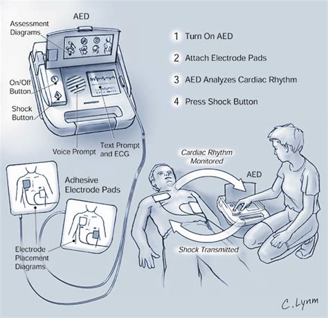 Elevated solo latch aed defibrillator use Notebook Outdoor Paving