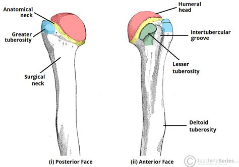 Humeral Shaft Fracture - TeachMeSurgery