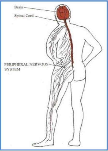 Multifocal Motor Neuropathy