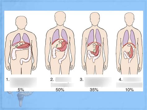 Body Habitus Diagram | Quizlet