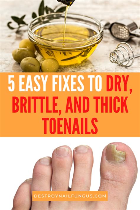 5 Easy And Effective Tips On How To Get Rid Of Dry Toenails