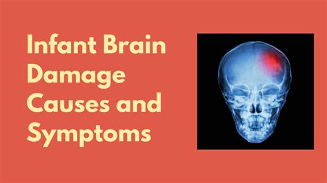 Infant Brain Damage Causes and Symptoms