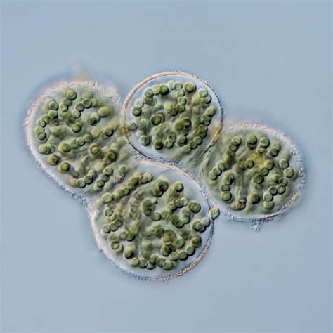 Nostoc Pruniforme Cyanobacteria Photograph by Gerd Guenther