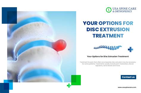 Your Options for Disc Extrusion Treatment - USA Spine Care - Laser ...