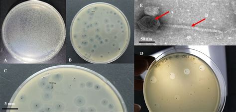 The presence of bacteriophage in the studied sample. A, B, and C:... | Download Scientific Diagram