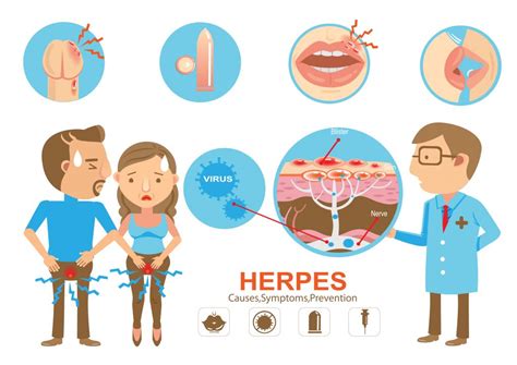 Kan cannabis herpes helen? - Mediwietsite