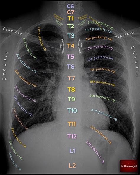 theRadiologist on Twitter | Radiology student, Medical school stuff, Medical school life