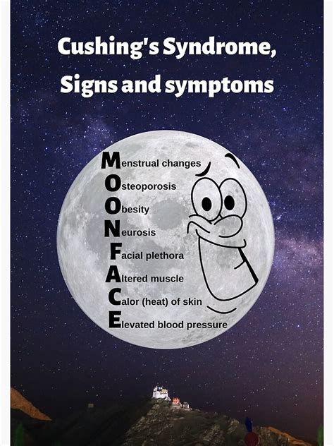 "Cushing's Syndrome, Signs and Symptoms: MOON FACE Mnemonic" Photographic Print for Sale by ...