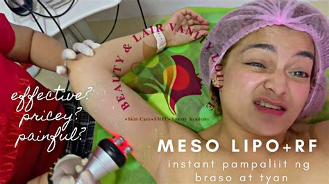 MESO LIPO + RF CAVITATION | NON SURGICAL LIPO TREATMENT - YouTube