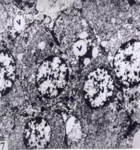 Zona fasciculata cells of heroin treated rat on day 30 showing... | Download Scientific Diagram