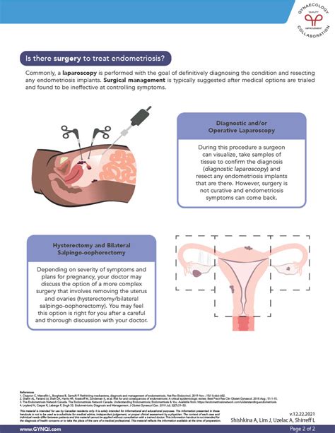 Endometriosis Treatment - Hormonal & Surgical Options (PDF)