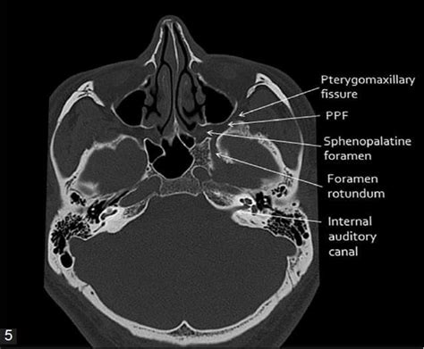 an x - ray shows the location of the cranium in the lower limb