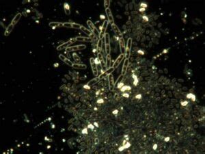 Darkfield & Brightfield Microscopy: Understanding the Techniques