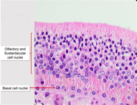 Nasal Cavity Labeled : Seer Training Nose Nasal Cavities Paranasal Sinuses - It constitutes the ...