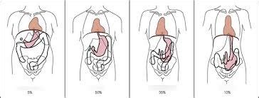 Body Habitus Diagram | Quizlet