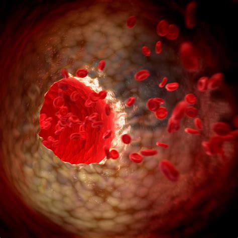 Division of Cardiology Research | NYU Langone Health