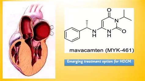 Mavacamten provides sustained improvement of HOCM symptoms even beyond ...