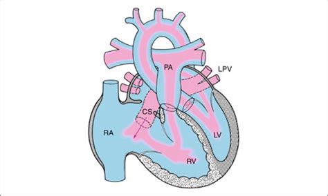 Best Cabg Surgeons In India, Top Surgeon In Mumbai, India