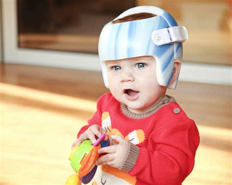 Plagiocephaly Intervention: Positioning and Remoulding