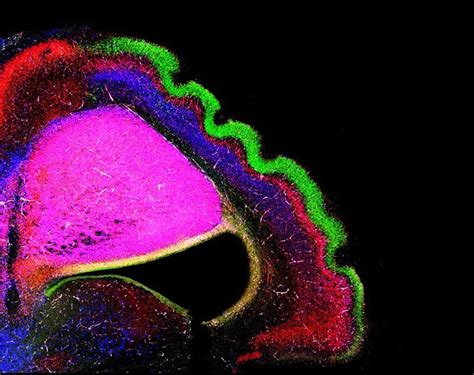 The Formation of Folds on the Surface of the Brain - Neuroscience News