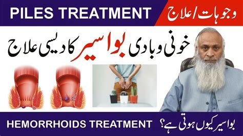 Piles Causes & Treatment - Khooni Aur Badi Bawasir Ka Ilaj - Bawaseer Ka Ilaj by Hakeem Babar ...