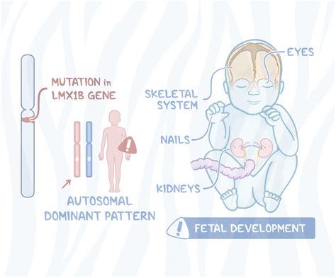 Elsevier Healthcare Hub | Rare Diseases | Nail-Patella Syndrome