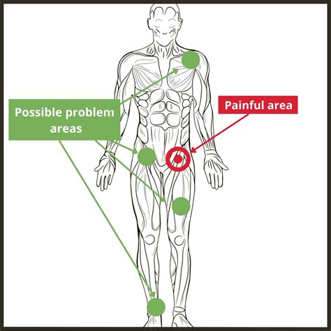 Intense Hip Pain When Sitting Online | aria-database.com