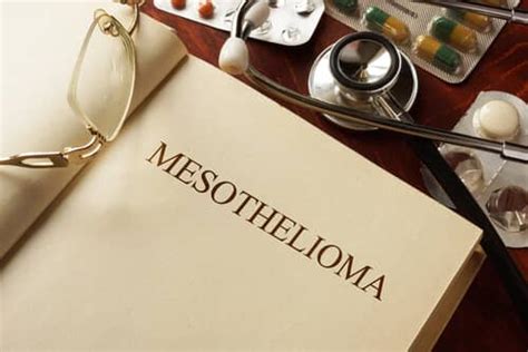 Best Mesothelioma Treatment Options in Illinois