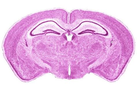 Shematic Of Mouse Brain Coronal Section