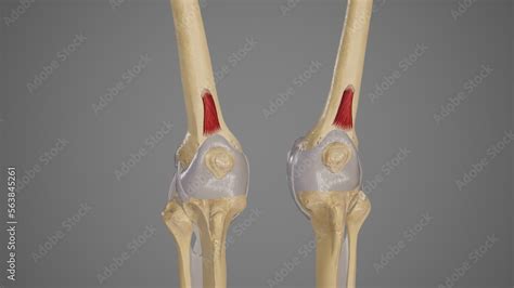 Medical Illustration of Articularis Genus Muscle Stock Illustration ...