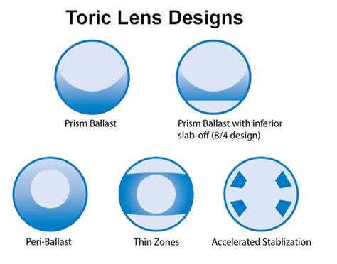 OPSC3113 - Outcome 4 - Techniques for Fitting Soft Toric Lenses ...