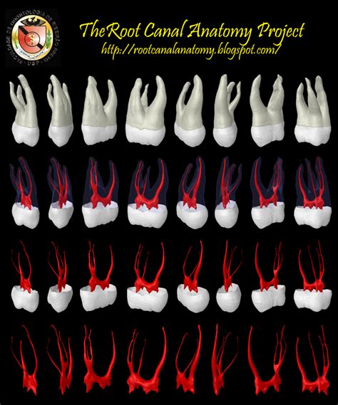 The Root Canal Anatomy Project: Maxillary Second Molar