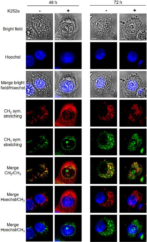 MCARS spectroscopy of HT29 cells incubated with K252a. HT29 cell lines ...