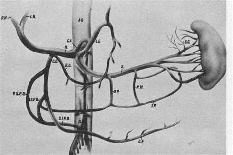 Pancreatic Angiography, with Application of Subselective Angiography of the Celiac or Superior ...