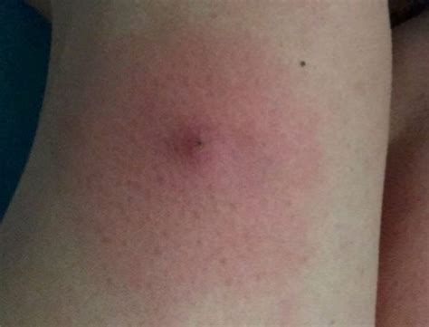 Mum and kids terrorised by suspected woodlouse spider in their home