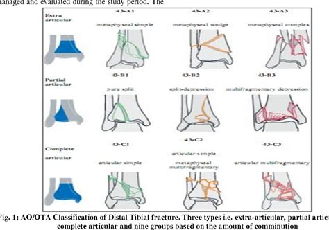 Figure 1 from Outcome of Minimaly Invasive Plate Osteosynthesis (MIPO) Technique with Locking ...