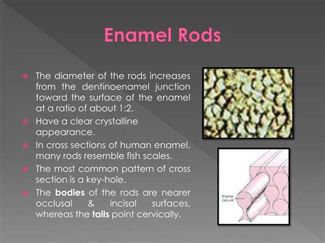 PPT - Enamel PowerPoint Presentation, free download - ID:2255941