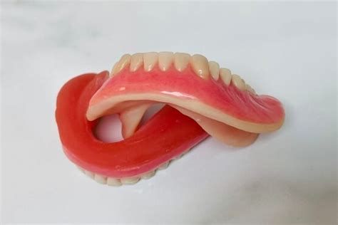 Soft Liners - South Point Denture Clinic