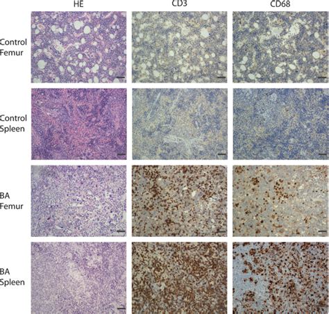 Histology shows expansion of inflammatory cells in BA mice. Tissue... | Download Scientific Diagram