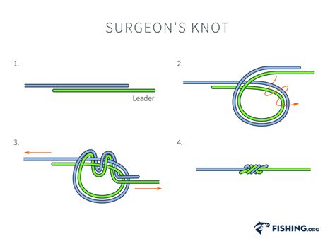 Surgeon's Knot Weaving at marionhgilbert blog