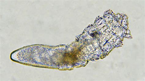 Meet The Mites That Live On Your Face | NCPR News