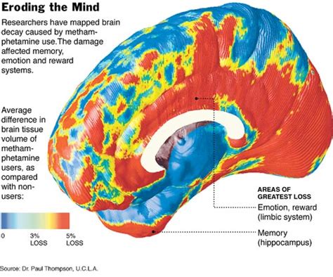 Brain Damage: How Meth Affects Your Brain - Bridges Of Hope