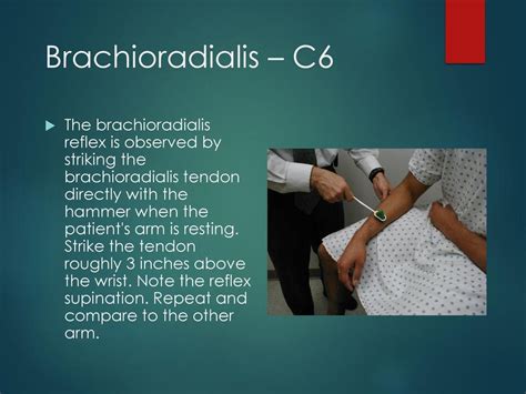 Brachioradialis Reflex