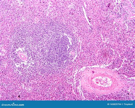 Histology of Human Pancreas Tissue Stock Photo - Image of kidney ...